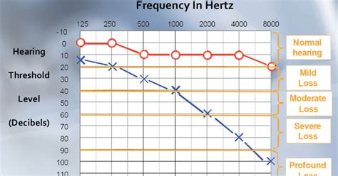 auditgram|What is An Audiogram And How To Read It .